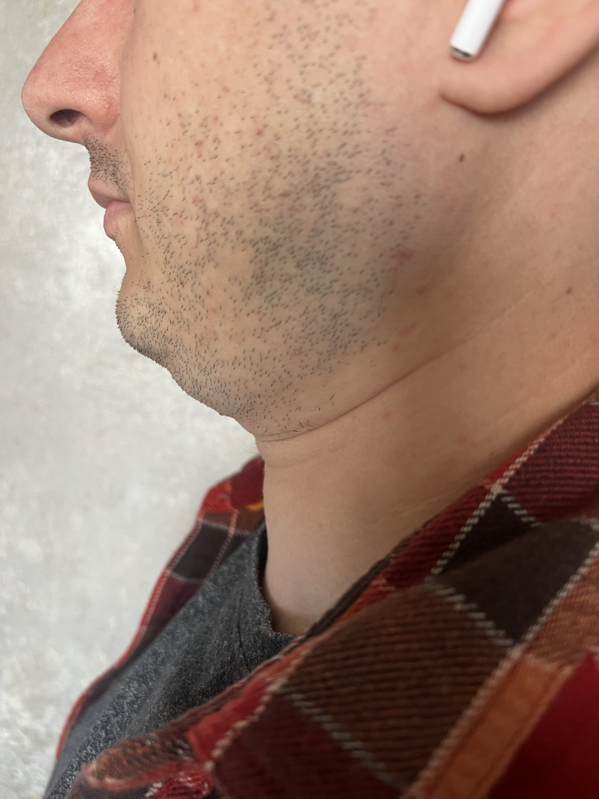 Not Fat But Have a Double Chin: Causes, Reasons, and What You Can Do